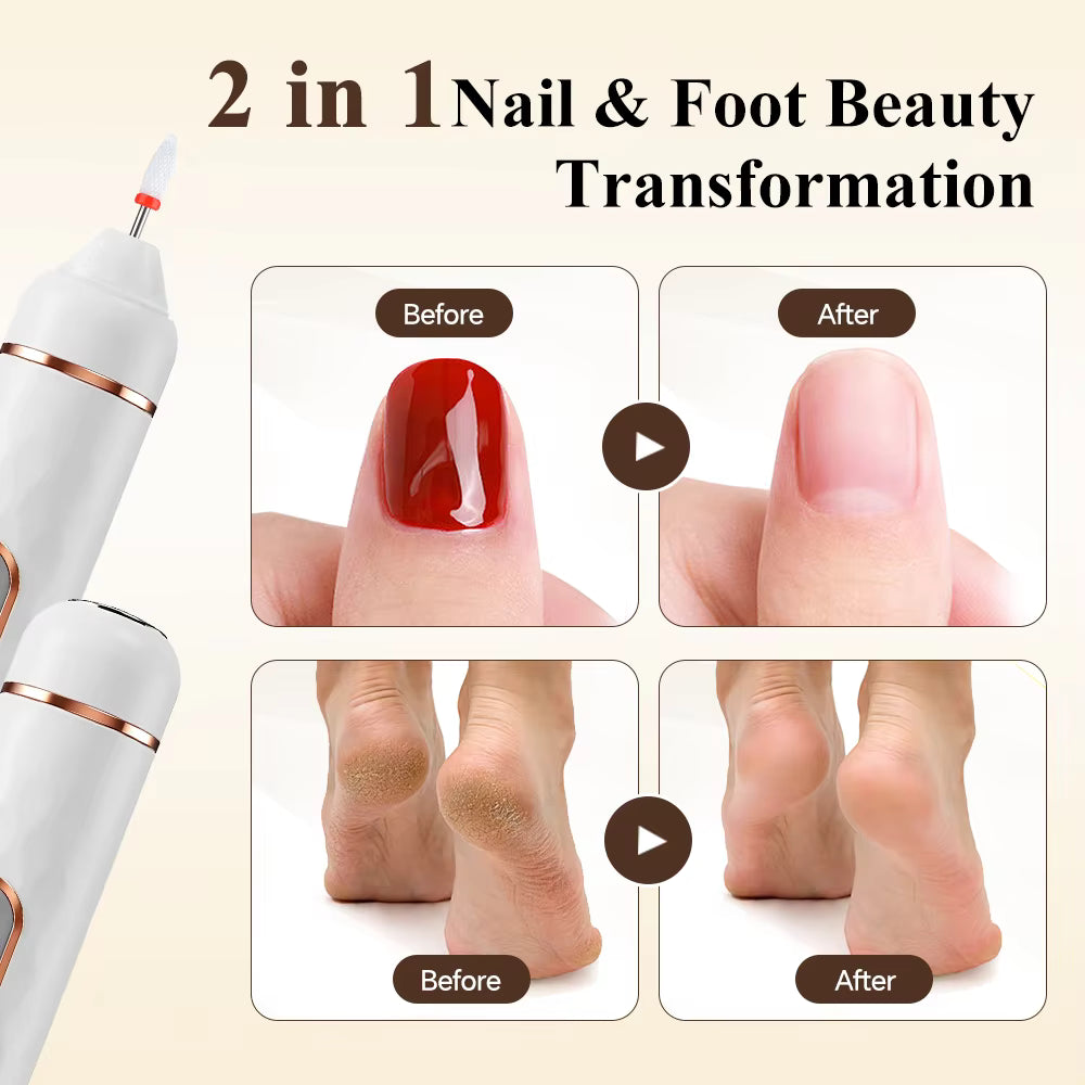5-in-1 Rechargeable Electric Foot Callus Remover & Nail Pedicure Kit