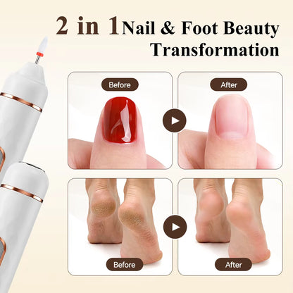 5-in-1 Rechargeable Electric Foot Callus Remover & Nail Pedicure Kit